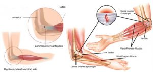 Anatomy of elbow joint