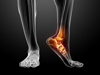 Best Foot Braces for Drop Foot- Reviews, Specs & Buyer’s Guide