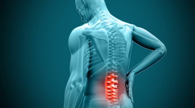 Best Back Braces For Herniated Disc – Reviews, Specs & Buyers’s Guide
