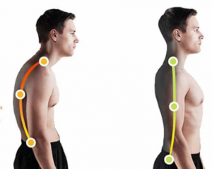 back braces for posture