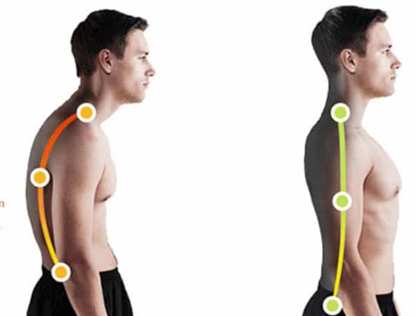 back braces for posture
